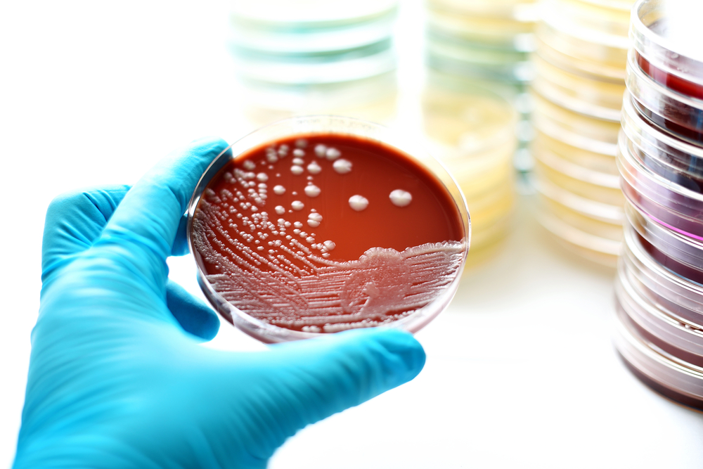 A hand with a blue rubber glove holding on to a petri dish with bacteria in it. It shows that the cooling tower tested positive for Legionella.